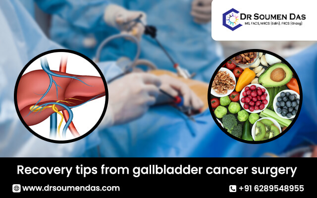 recovery tips from gallbladder cancer